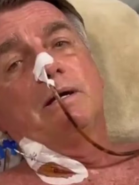 Jair Bolsonaro fue operado con éxito por una obstrucción intestinal y permanece en observación