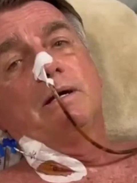 Jair Bolsonaro fue operado con éxito por una obstrucción intestinal y permanece en observación