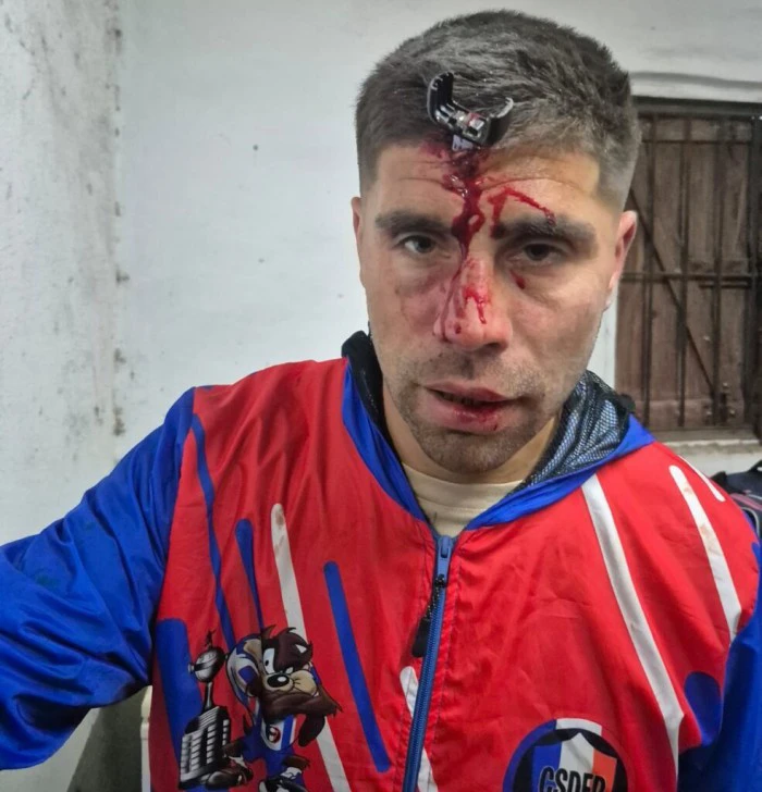 Un hombre le clavó una llave en la cabeza a un padre después de un partido de fútbol juvenil